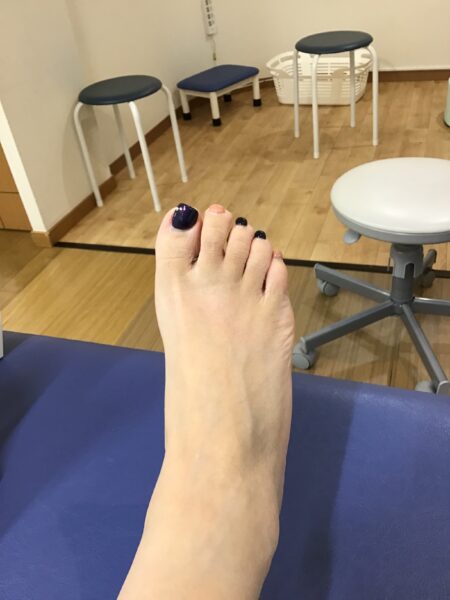 50代女性（練馬区）施術前