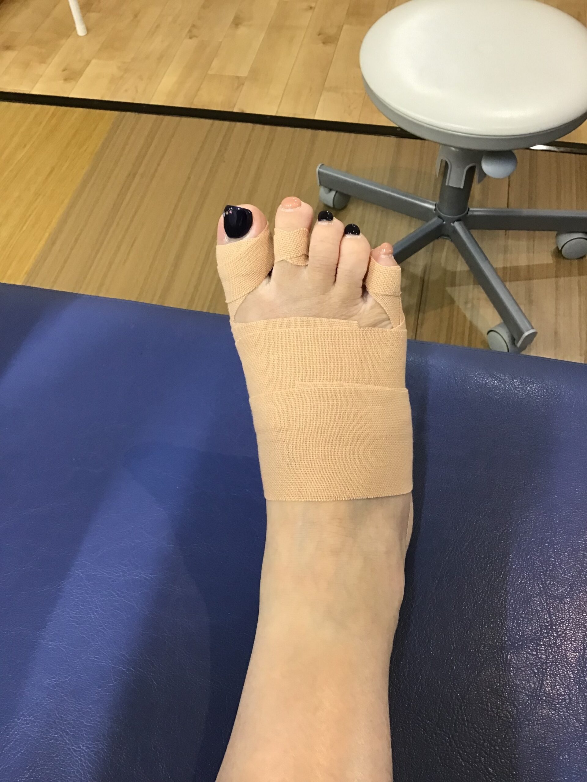 50代女性（練馬区）施術後