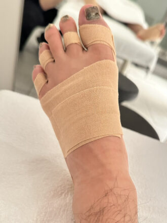 20代男性（中央区）施術後