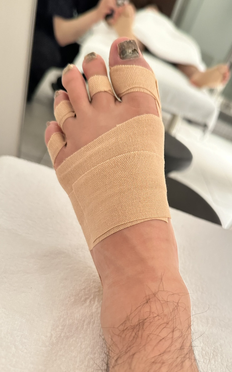 20代男性（中央区）施術後