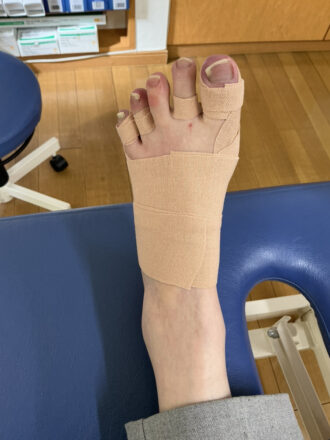 60代女性（練馬区）施術後