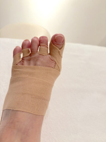 70代女性（千代田区）施術後