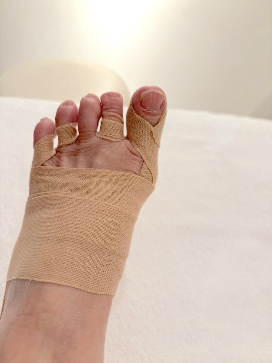 70代女性（千代田区）施術後