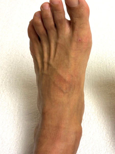 50代男性（茨城県）施術前