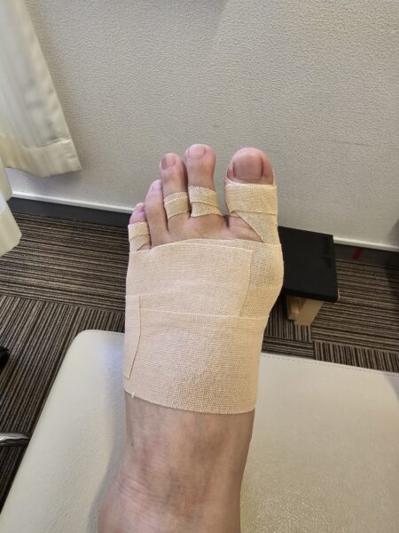 50代女性（熊本市からお越しの方）施術後