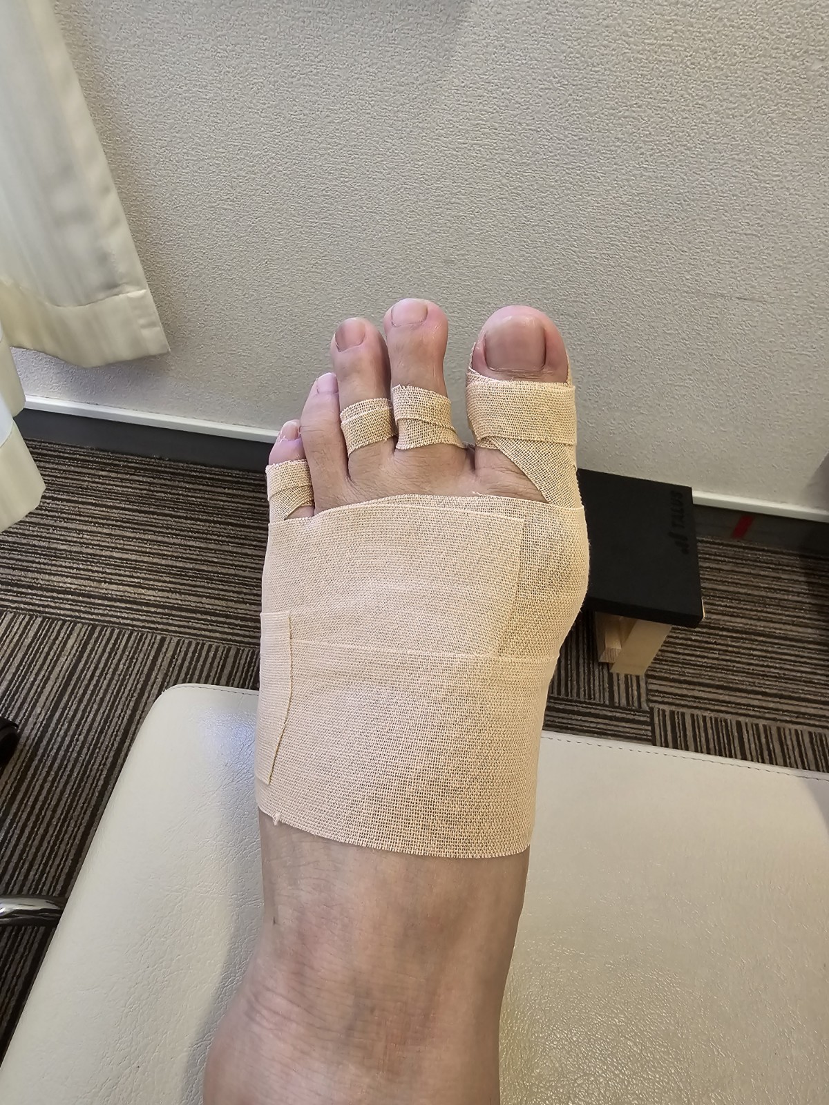 50代女性（熊本市）施術後