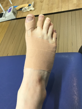 40代女性（練馬）施術後