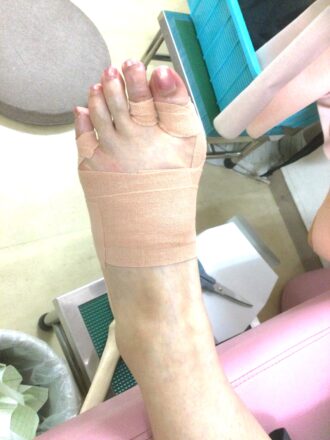50代女性（八王子市）施術後