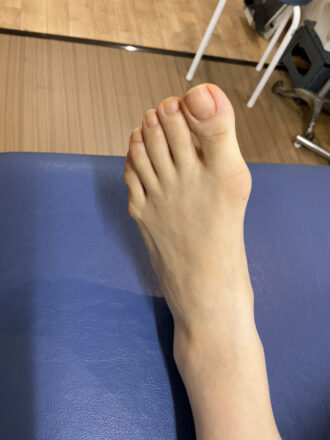 50代女性（練馬）施術前