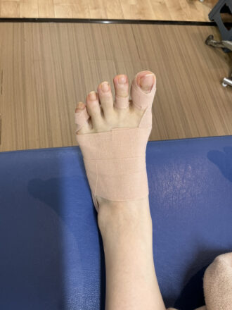 50代女性（練馬）施術後