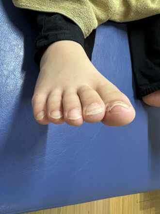 10代男性（練馬）施術後