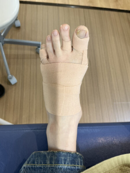 施術後