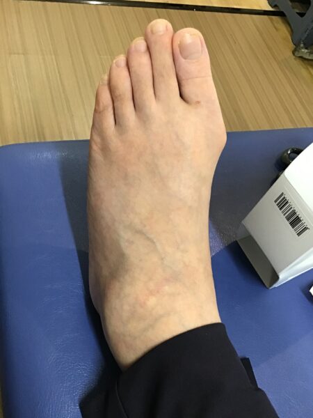50代女性（練馬区からお越しの方）施術前