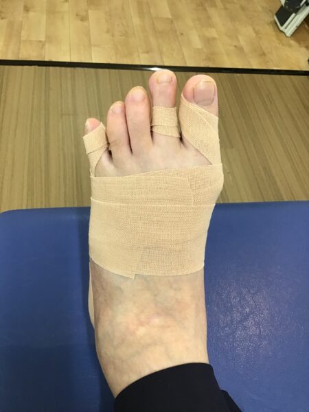 50代女性（練馬区からお越しの方）施術後