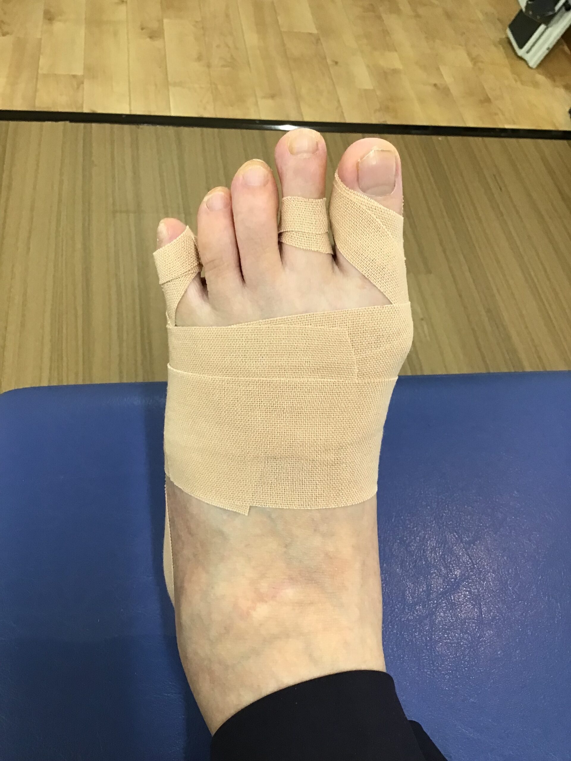 50代女性（練馬区）施術後