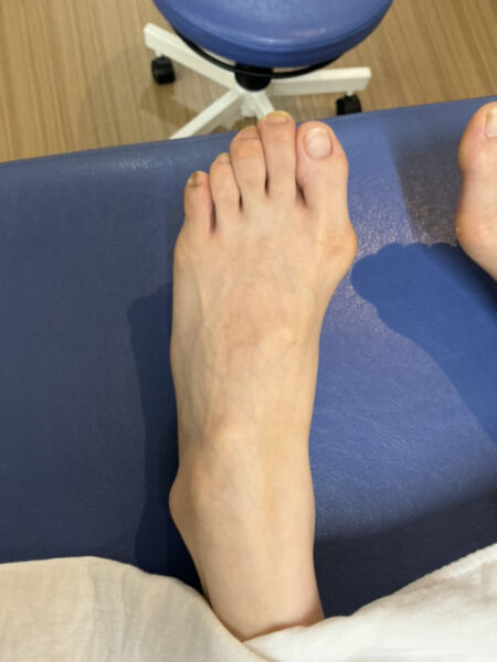 20代女性（練馬区からお越しの方）施術前