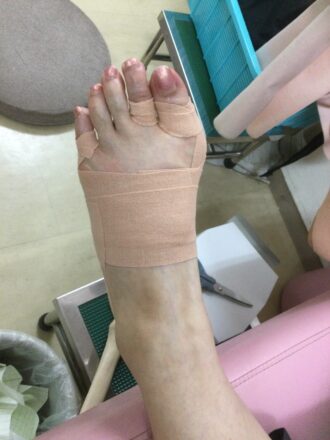 50代女性（八王子市）施術後