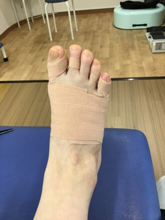 50代女性（練馬区）施術後