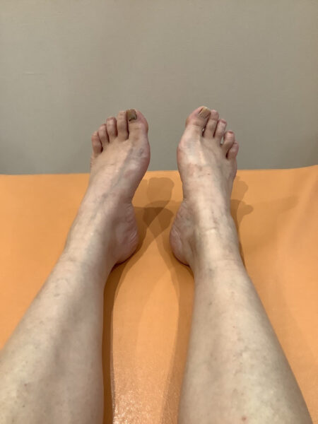 40代女性（岡崎市）施術前