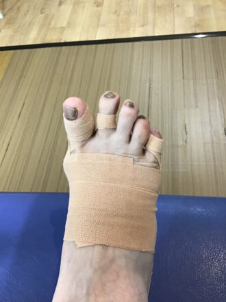 50代女性（練馬区）施術後